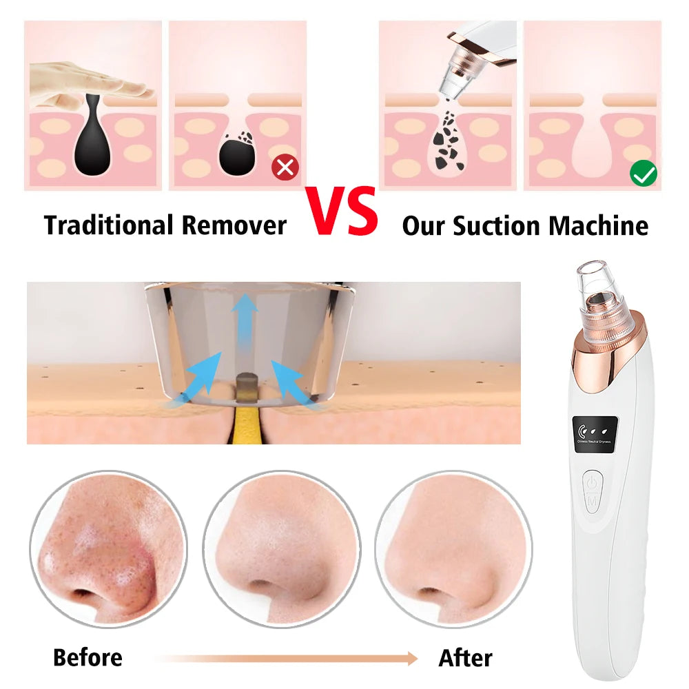 PureGlow  3-Mode Blackhead Vacuum Cleanser