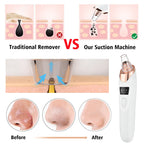 PureGlow  3-Mode Blackhead Vacuum Cleanser