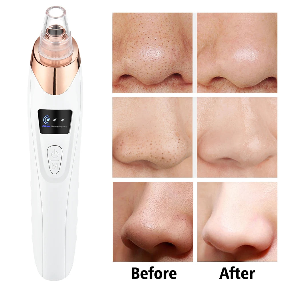 PureGlow  3-Mode Blackhead Vacuum Cleanser